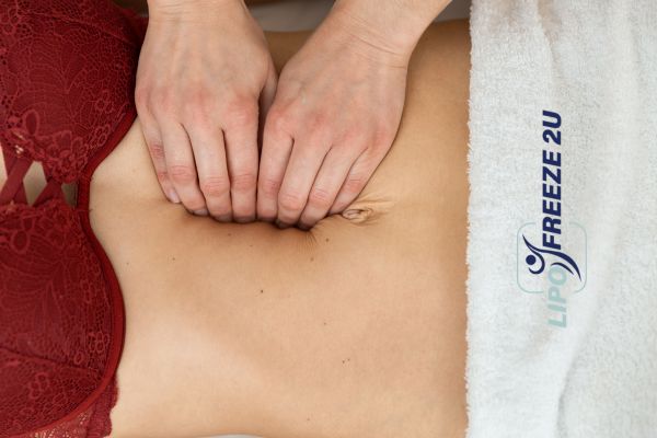 diastasis recti treatment Ely