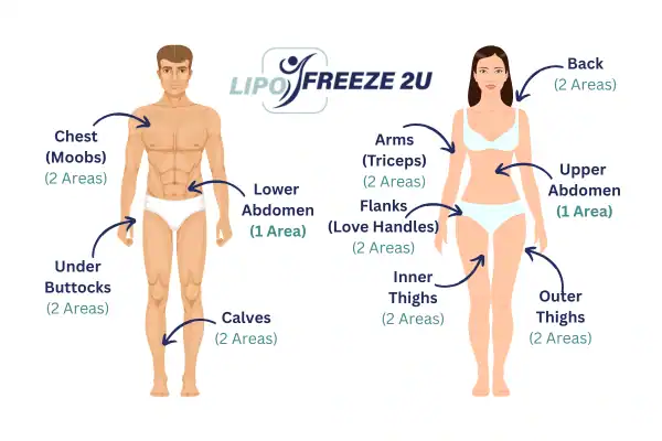 Areas you can have fat freezing treatment Ely