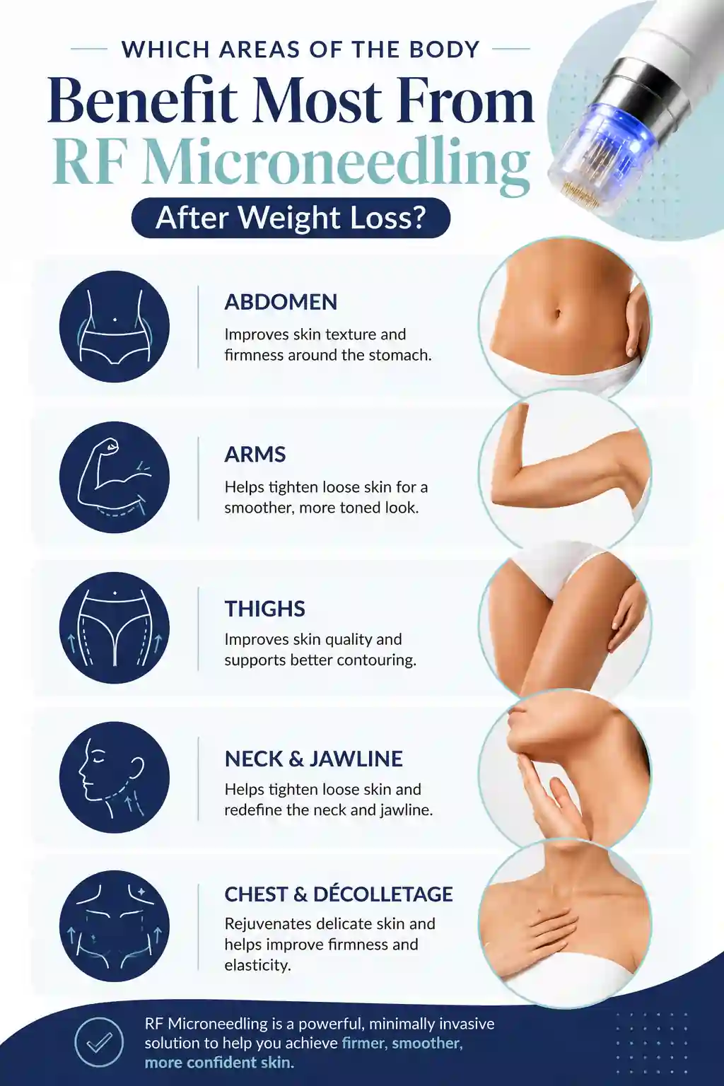 Which Areas of the Body Benefit Most From RF Microneedling After Weight Loss Ely